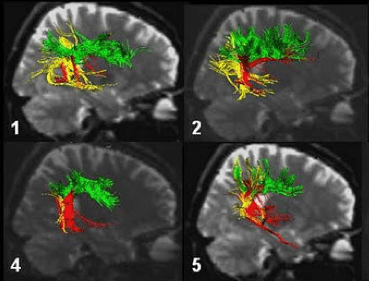 En torno al Programa del Primer Cuatrimestre 2012